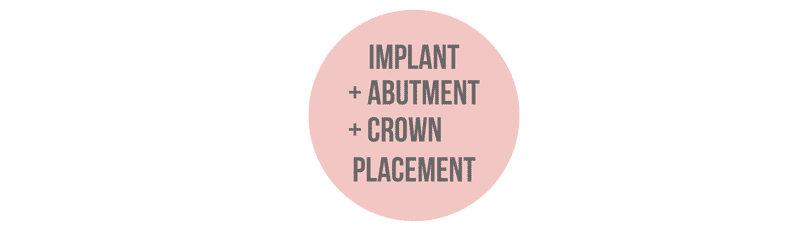 1 day dental implant procedure