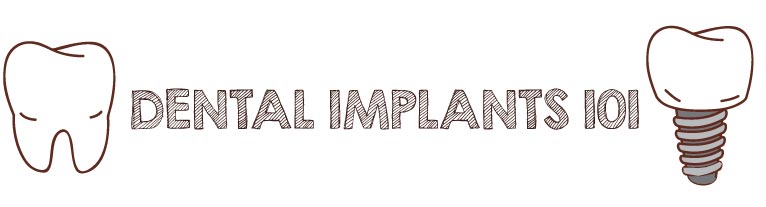 dental implants 101
